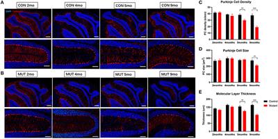 Social Deficits and Cerebellar Degeneration in Purkinje Cell Scn8a Knockout Mice